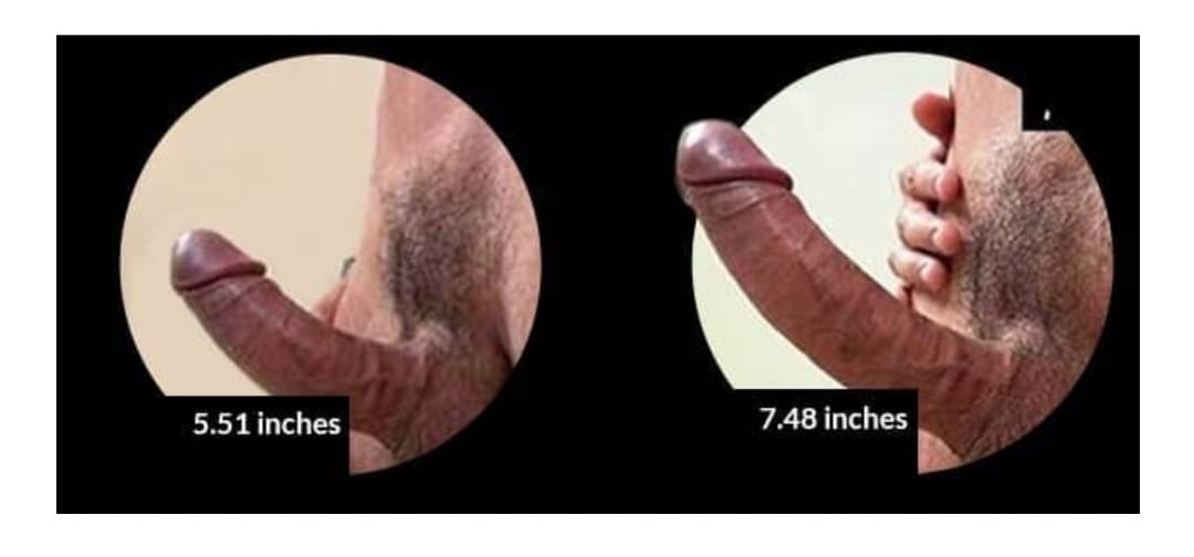 6537789